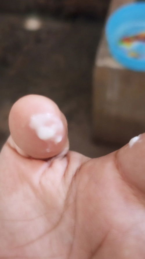 แบบนี้คืออะไรคะอันตรายมั้ยอยู่ๆก็มี แต่ว่าไม่มีอาการคันหรือปวดท้องค่ะ