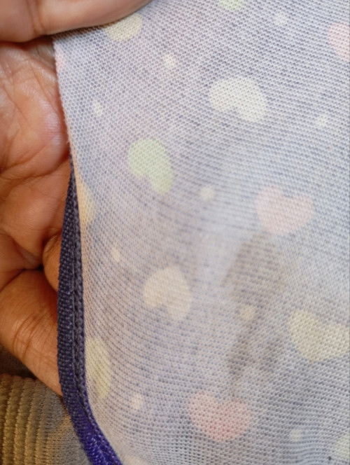 Apakah seperti ini termasuk flek bun?
Saat ini usia kehamilan saya 8week.