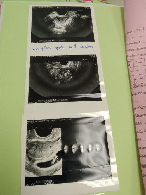 อยากสอบถามแม่ๆบ้านอื่น