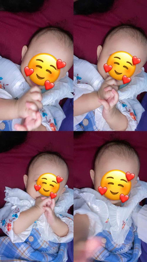 Kepala bayi ada garis seperti bando