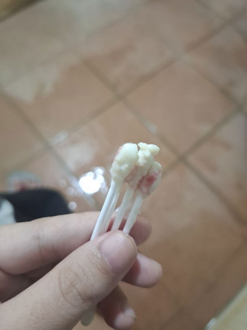 ตกขาวปนเลือด