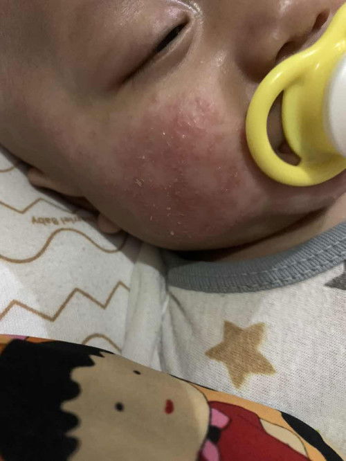 Bun mohon bantuannya