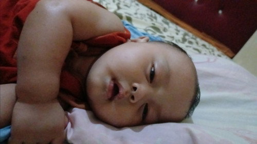 Tidur mata terbuka