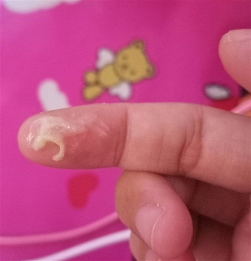 Assalamaulaikum nak kepastian ada ke ini tanda2 bersalin ?