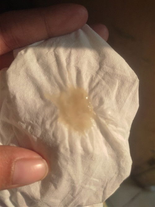 Pernah ada yang ngalamin? Atau tau ini apa?