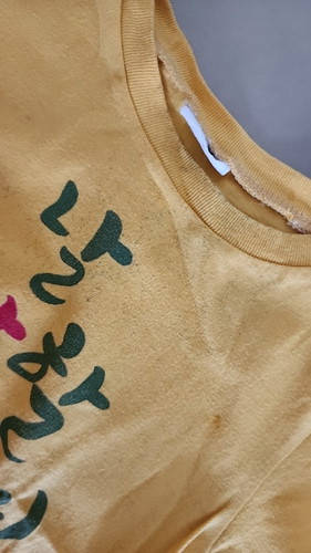 How to remove mould on baby's clothes
