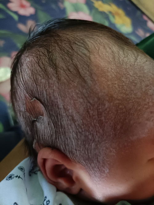 Putih lemak dikepala.