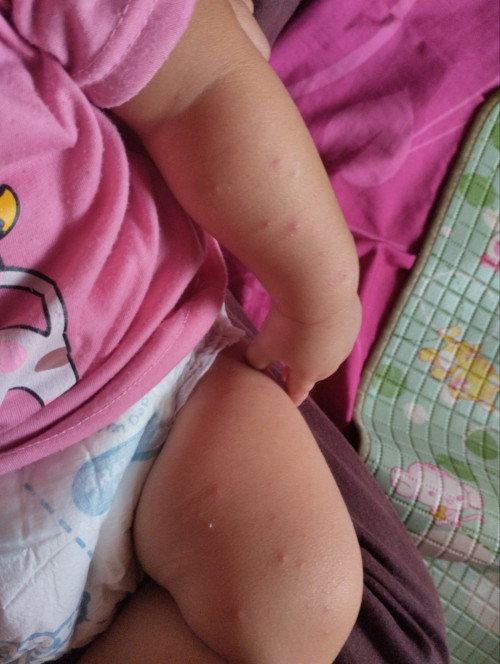 Sharing obat salep buat anak 6 bulan