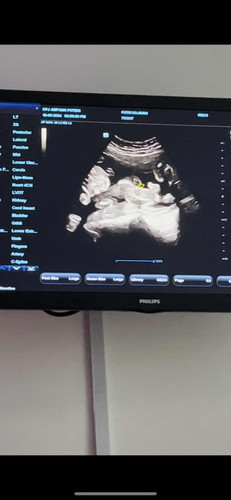 Baby Gender