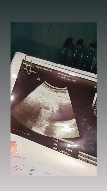 6w baru keliatan kantong