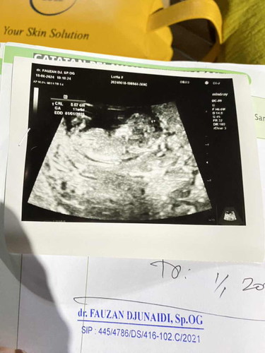 11 week 6 day