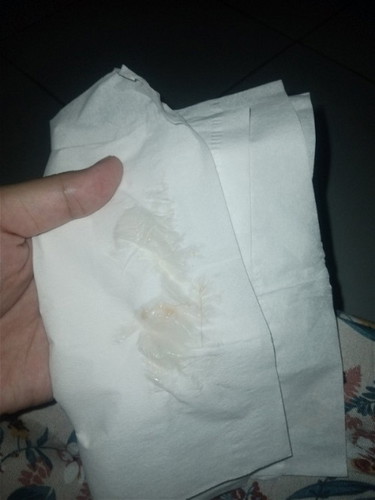 Flek/keputihan