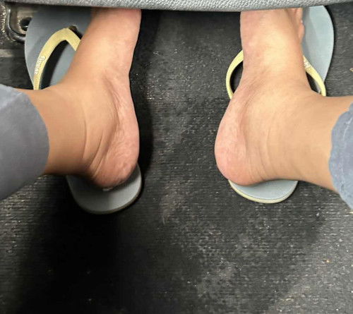 Kaki bengkak di kehamilan 36w