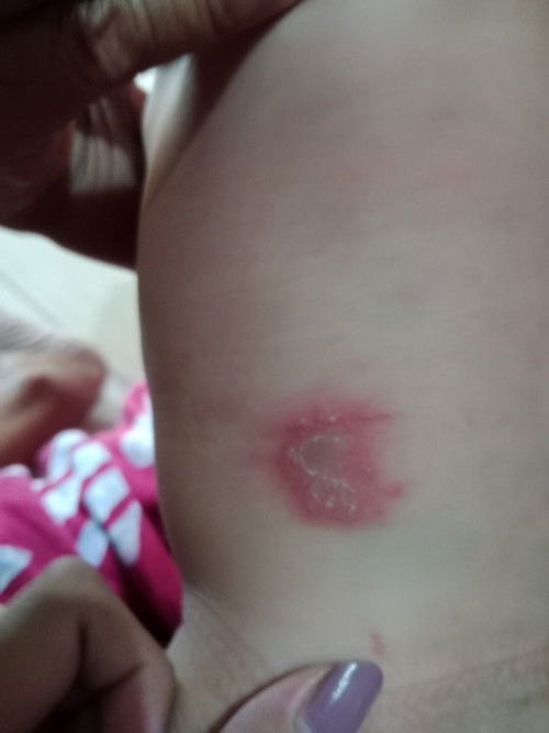 Bun ini apa ya obat nya