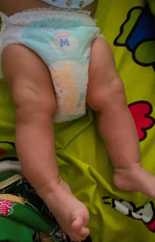 Bayi 3 bulan suka meregangkan kaki