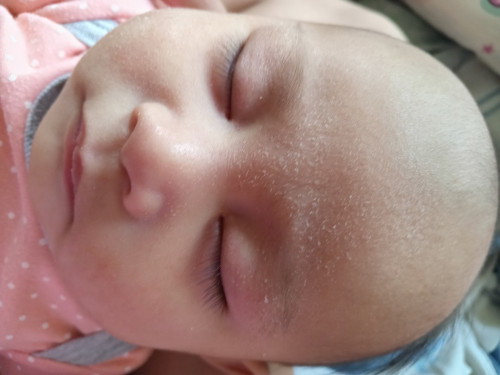Anong marerecommend niyo sa dry skin ni baby sa mukha