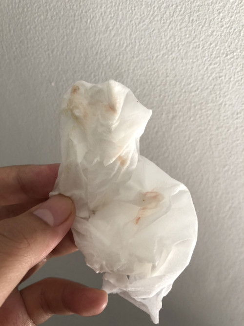 36W 5D HPL 13 juli, Keluar Lendir kecoklatan