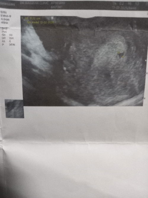 แบบนี้ใช่ถุงการตั้งครรภ์มั้ยคะแม่ๆช่วยดูหน่อยค่ะพอจะมีหวังบ้างมั้ยคะ