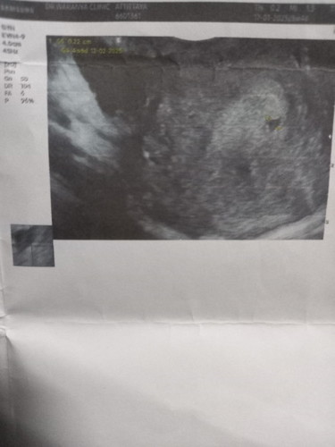 แบบนี้ใช่ถุงการตั้งครรภ์มั้ยคะแม่ๆช่วยดูหน่อยค่ะพอจะมีหวังบ้างมั้ยคะ