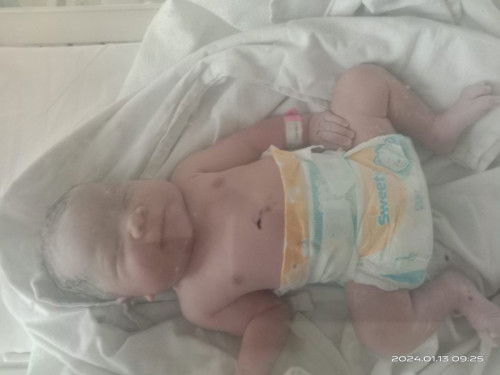 Pengalaman melahirkan kedua ku