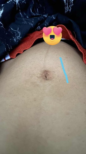 ตั้งครรภ์ลูกดิ้น