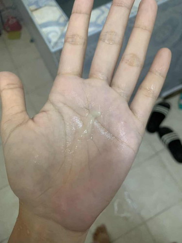 สอบถามค่ะ แม่ๆมีอาการแบบในรูปไหมค่ะ