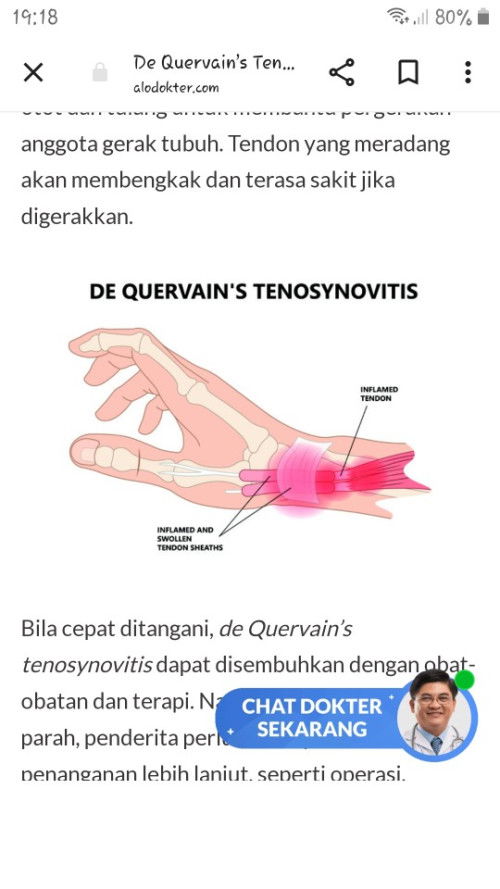 Mommy wrist atau ( sindrom De Quervain