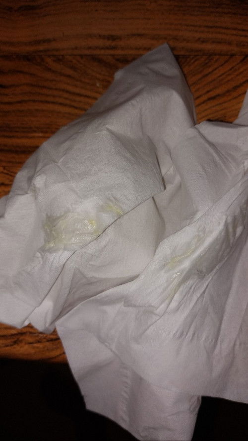 Keputihan dikehamilan 6 week