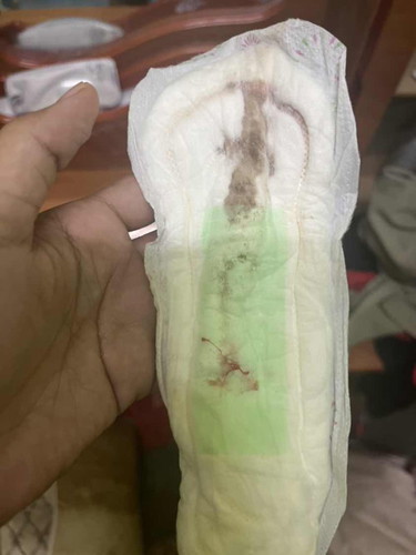 7week kalau keluar mcm ni adakah normal? atau tnda2 keguguran