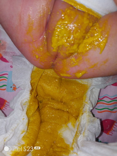 ASK KO LANG PO NORMAL BA UNG GANYAN POOP NI BABY FORMULA 1MONTH AND 5DAYS?