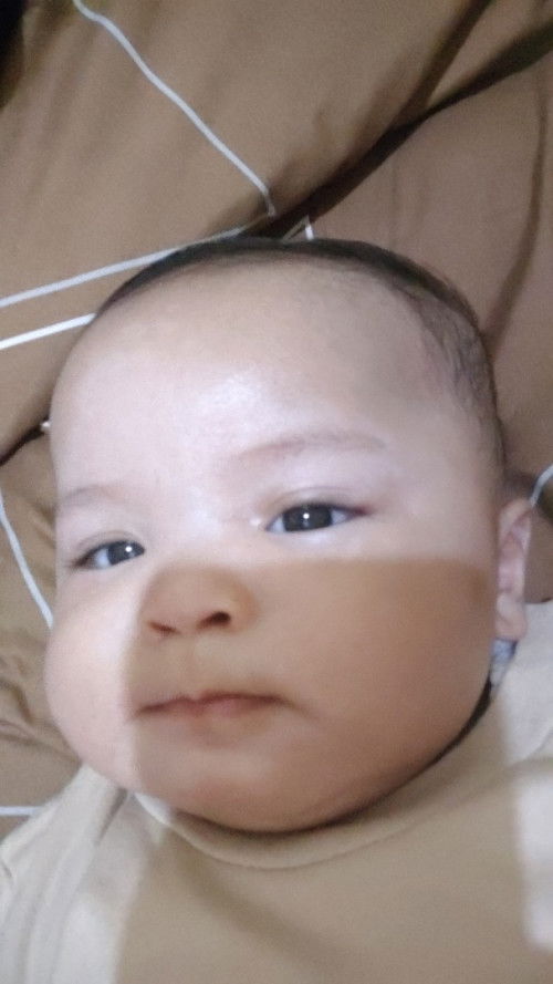 Muncuo bercak putih seperti panu