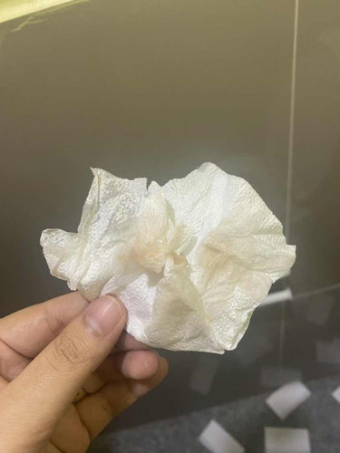 ท้อง7 วีคมีมูกสีน้ำตาล