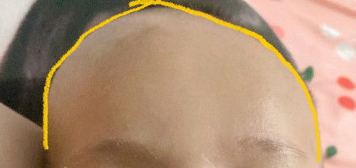 kepala tidak simetris