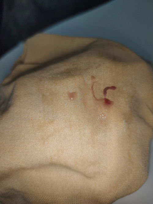 Spotting or something? 🤣