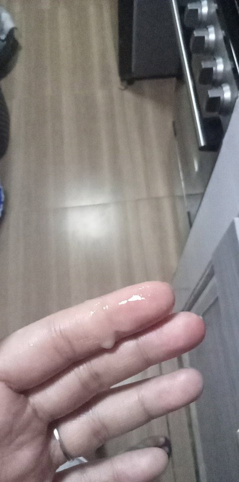 Discharge na lumalabas after mag wiwi