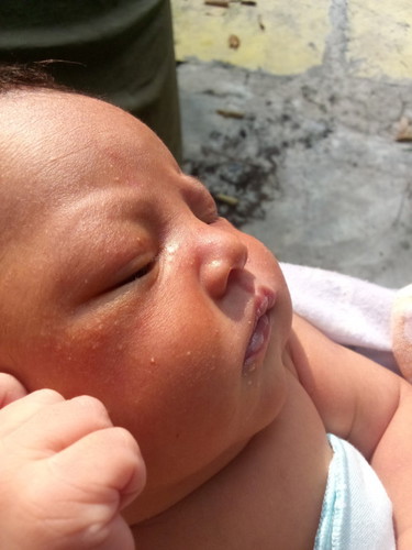 bintik putih