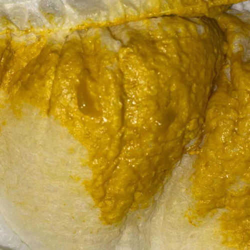 น้องอึเหมือนมีมูก