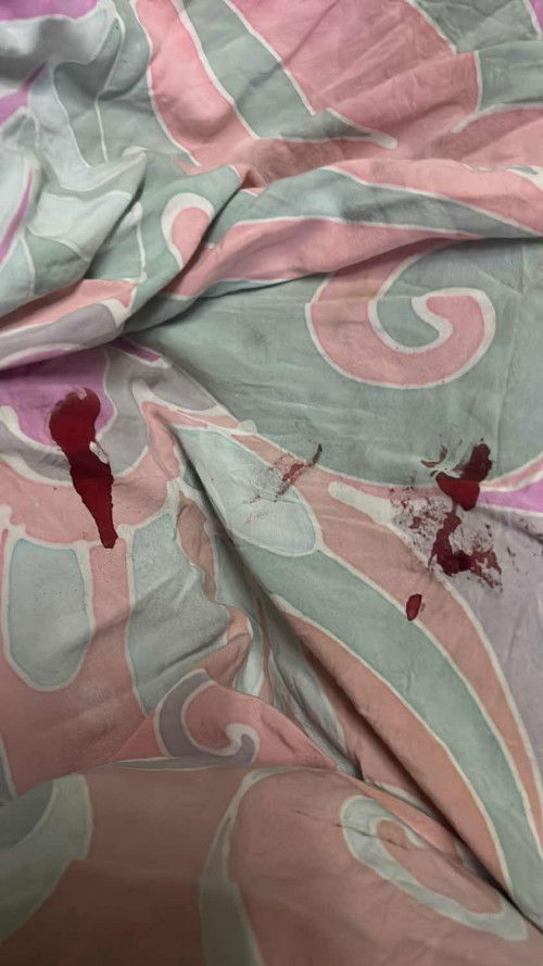 mula2 coklat sekarang darah ,