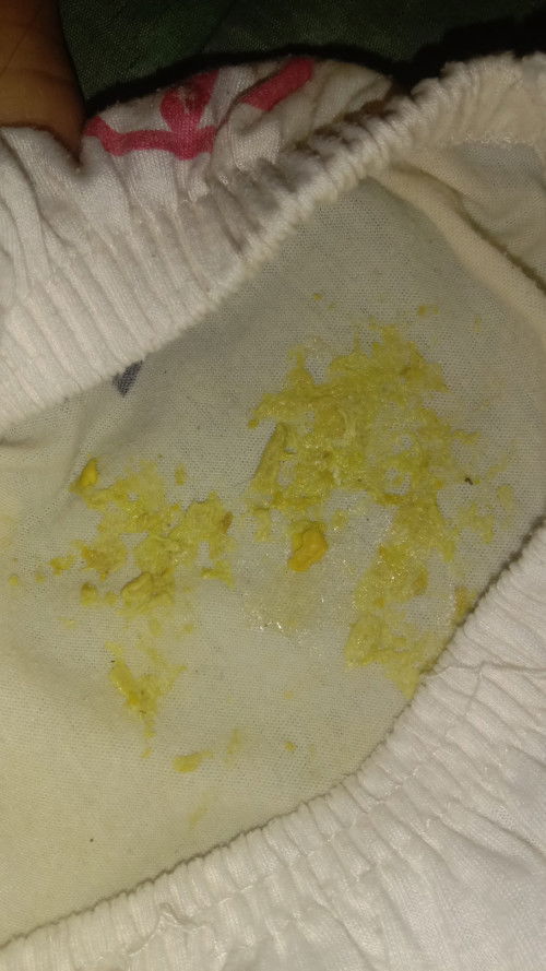 Pup anak 14bulan berwarna pucat