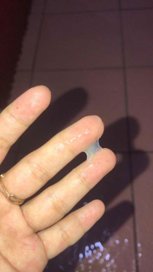 Keluar lendir di 37 week