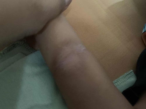 kulit baby kisut kering