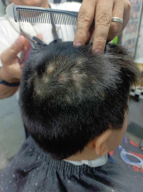 Help, tutubuan paba ng buhok