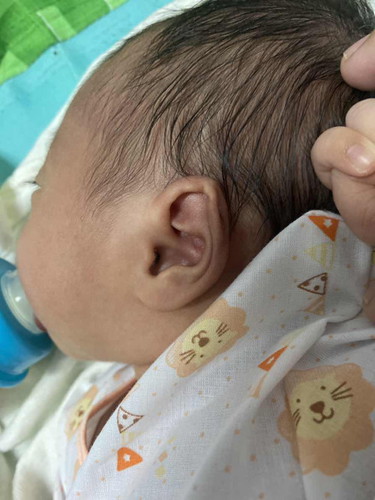 ลูกหูหยักอายุ12วัน