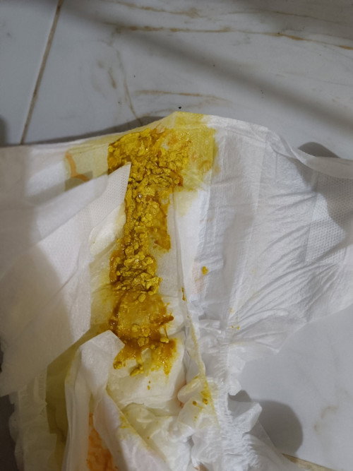 BAB bayi 2 bulan kuning pucat/tidak dan berlendir