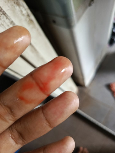 Normal ke keluar darah
