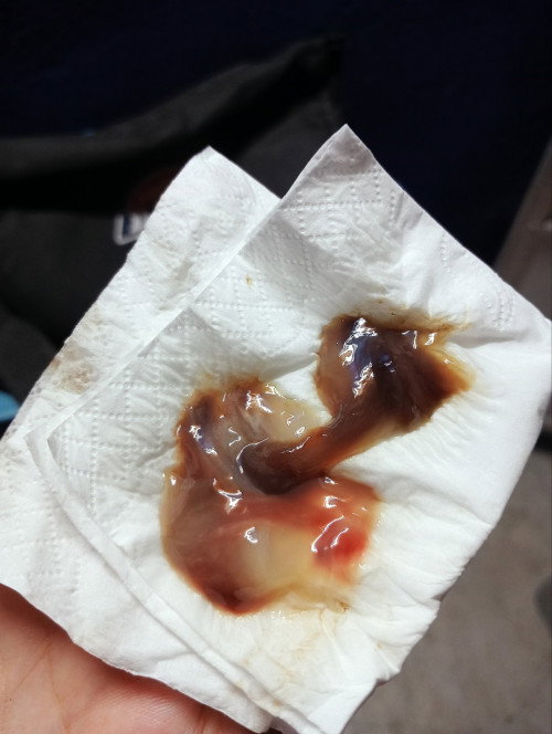 สอบถามแม่ๆหน่อยค่ะ