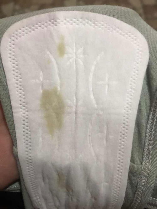 Darah nifas atau keputihan