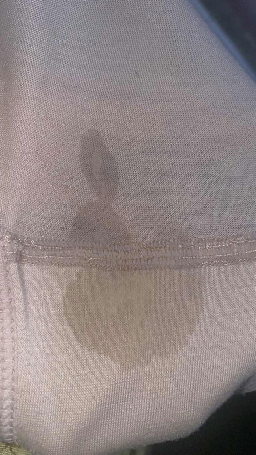 20 week keluar cairan apa ya?