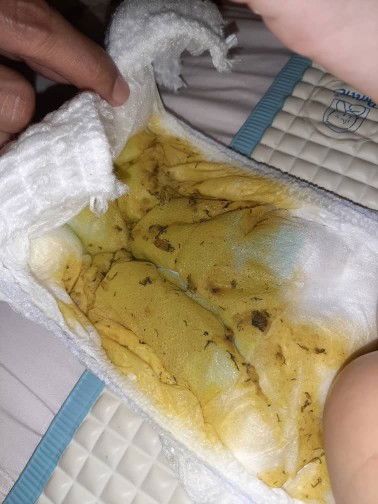 Najis berwarna kuning dan cair.