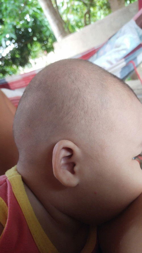 แบบนี้หัวเริ่มแบนรึป่าว